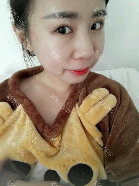 默默_519697第8天美丽日记-新氧美容整形