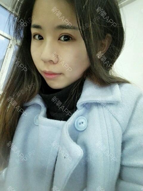 默默_519697第8天美丽日记-新氧美容整形