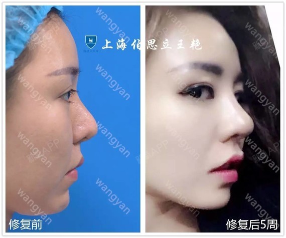 欧范儿小翘鼻,美过杨幂,辣过baby!