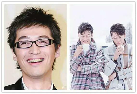 牙齿矫正,真的可以改变你的容颜
