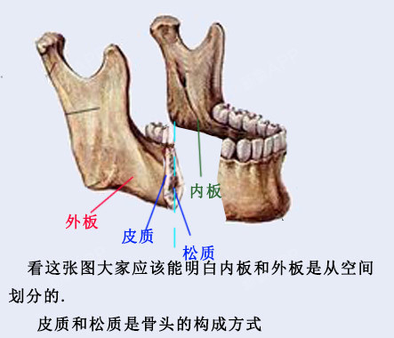 毕洪森:设计截骨线的时候一定要保证不要碰到颏孔,因为这个位置