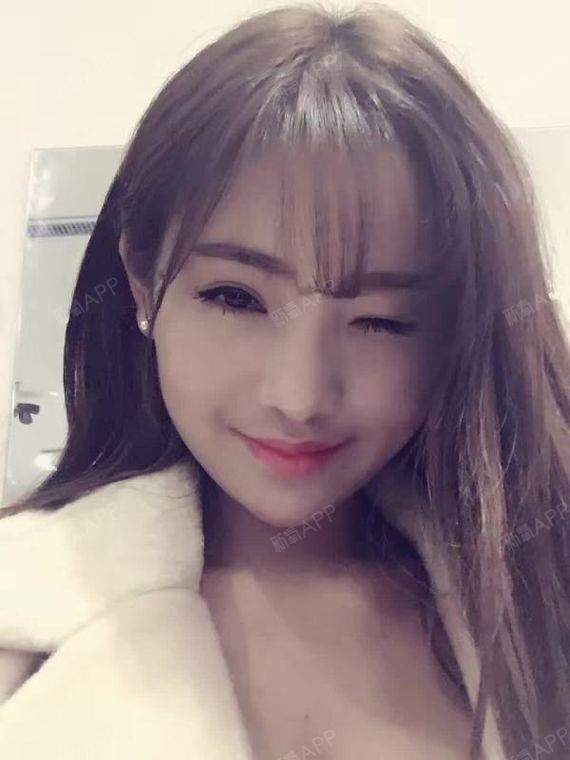 王爱琴自体脂肪填充全脸第30天美丽日记-新氧美容 ...
