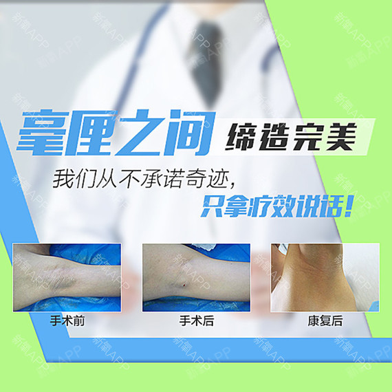 【除腋臭】治疗狐臭腋臭,顽固性与重度狐臭腋臭