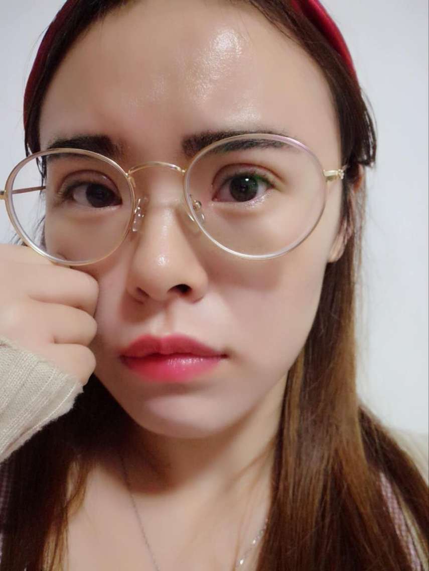 重庆当代整形美容医院切开双眼皮怎么样?_小黑白美丽