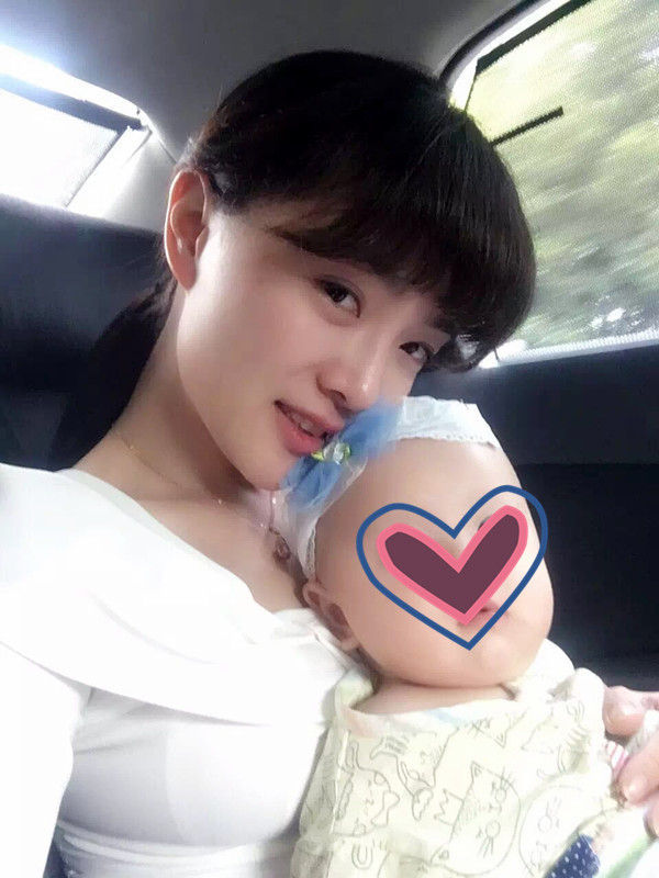 427天 术后