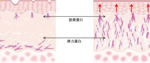 新氧 - 氧气姐 | 埋线提升 | 整形纯干货 新氧 - 氧气姐 | 埋线提升 | 整形纯干货