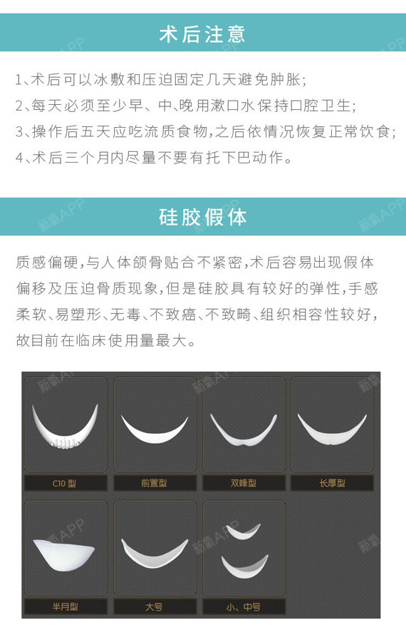 【硅胶垫下巴 假体垫下巴(万和假体 v脸线条女神范儿