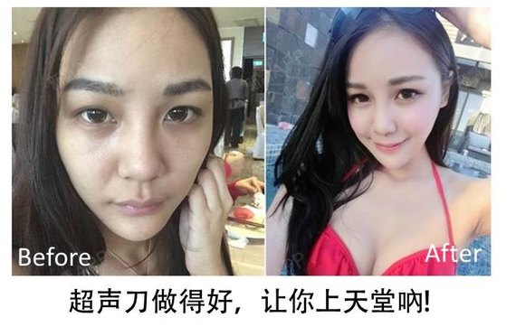 新氧 - 台妹湾湾 | 新氧 - 台妹湾湾 |