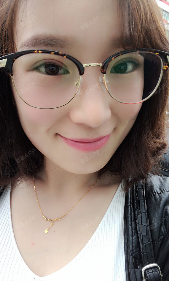 新氧 可爱的杨敏敏 切开双眼皮 术后当自强