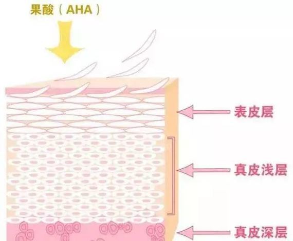 如今医学护肤领域的入门级别项目—果酸换肤!