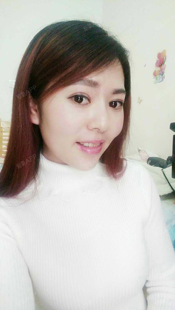 原来每个人都要经历马脸和婆婆嘴的过程,_圈子-新氧美容整形