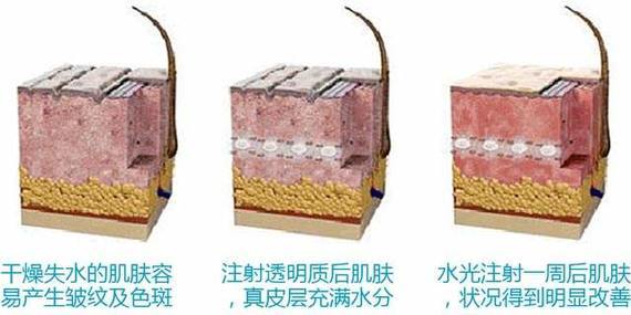 新氧 - 氧气姐 | 护肤 | 水光针 新氧 - 氧气姐 | 护肤 | 水光针