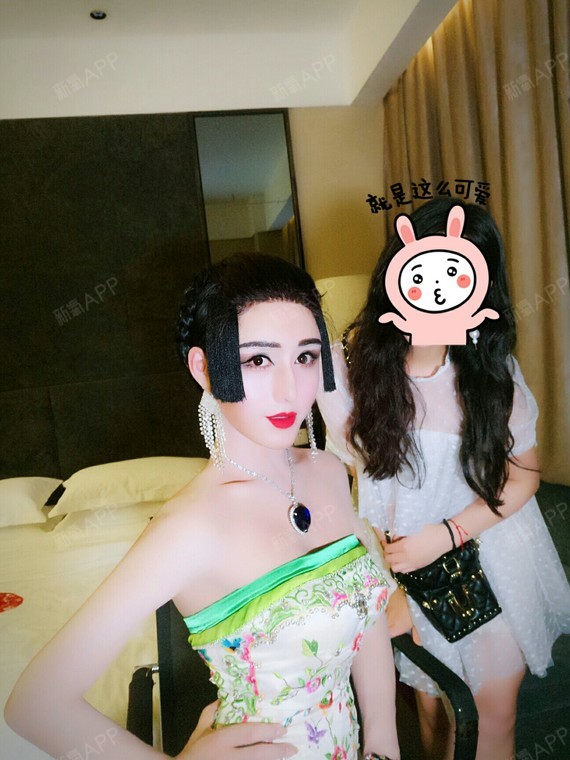 夏冰演员鼻中隔软骨隆鼻术后第370天美丽日记_新氧整形
