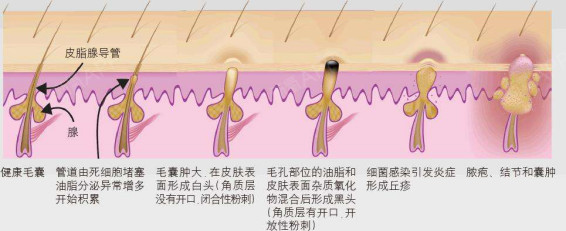 新氧 - 氧气姐 | 整形纯干货 | 谣言粉碎机 新氧 - 氧气姐 | 整形纯干货 | 谣言粉碎机