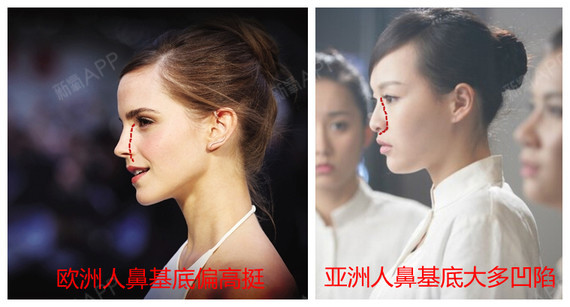 新氧 - 氧气姐 | 鼻部 | 隆鼻 | 鼻头整形 | 整形纯干货 新氧 - 氧气姐 | 鼻部 | 隆鼻 | 鼻头整形 | 整形纯干货