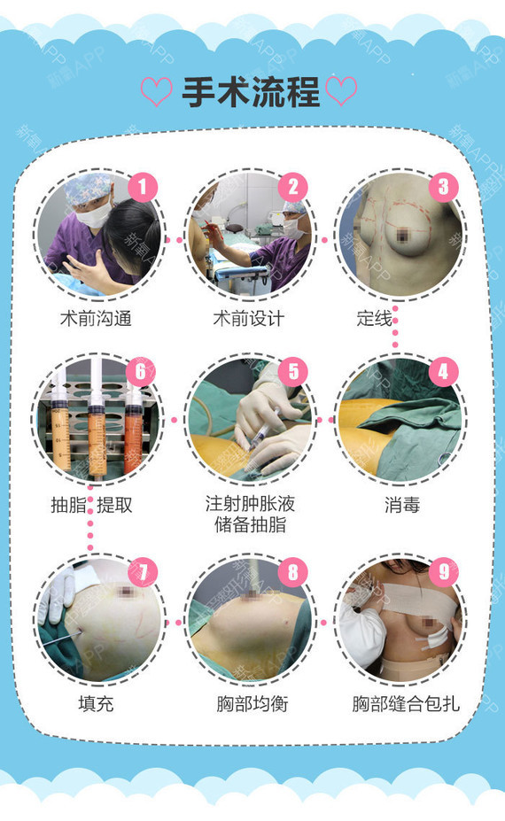 【自体脂肪填充】【自体脂肪隆胸】自体脂肪丰胸日记价3400元