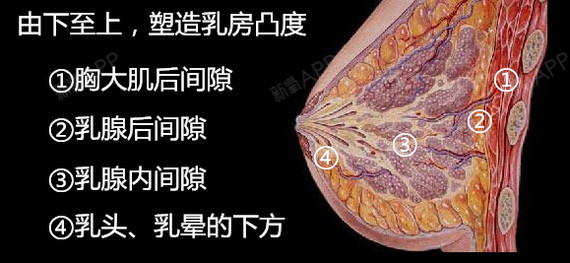 新氧 - 氧气姐 | 胸部 | 隆胸 新氧 - 氧气姐 | 胸部 | 隆胸