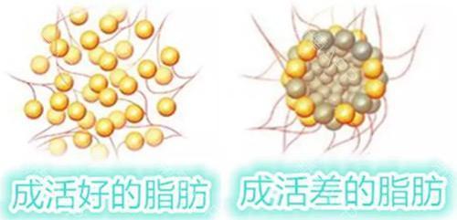 新氧 - 氧气姐 | 胸部 | 隆胸 新氧 - 氧气姐 | 胸部 | 隆胸
