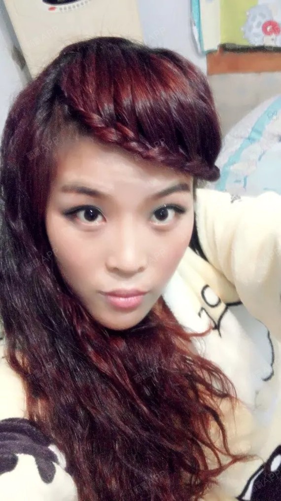 昆明欣奕医疗美容诊所:客服小助理A第36天美