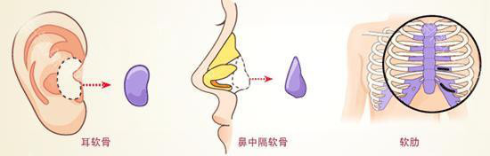 新氧 - 氧气姐 | 隆鼻 | 硅胶隆鼻 | 整形纯干货 | 鼻部综合 新氧 - 氧气姐 | 隆鼻 | 硅胶隆鼻 | 整形纯干货 | 鼻部综合