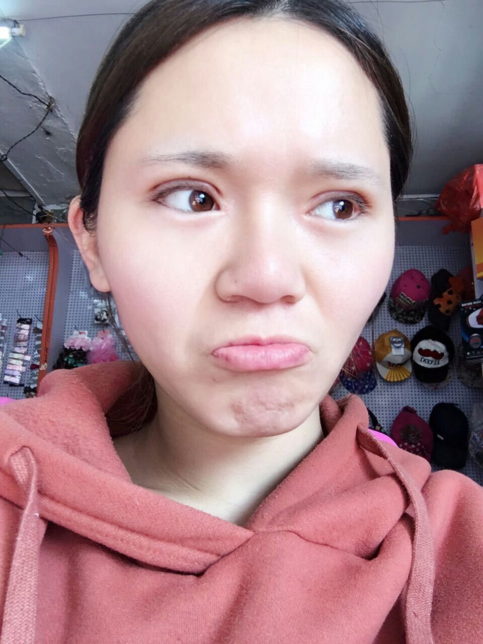 青岛海伦整形美容开内眼角怎么样_恢复过程_效果如何