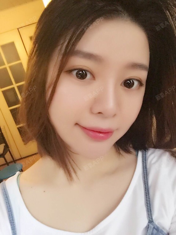 采蘑菇的小男孩玻尿酸垫下巴第100天美丽日记