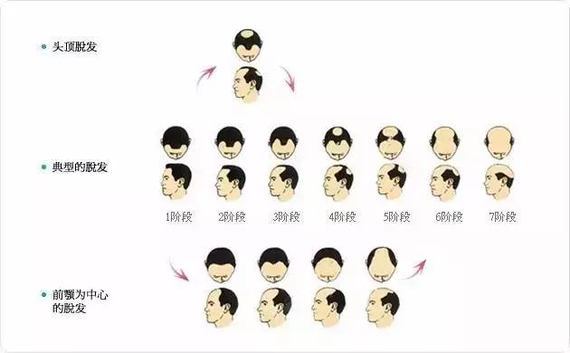 【猛料】周杰伦:我若秃了,你们还爱吗?周杰伦