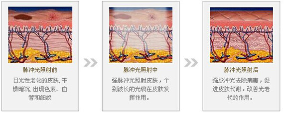 新氧 - 氧气姐 | 整形纯干货 | 氧姐科普 | 面部抗衰 新氧 - 氧气姐 | 整形纯干货 | 氧姐科普 | 面部抗衰