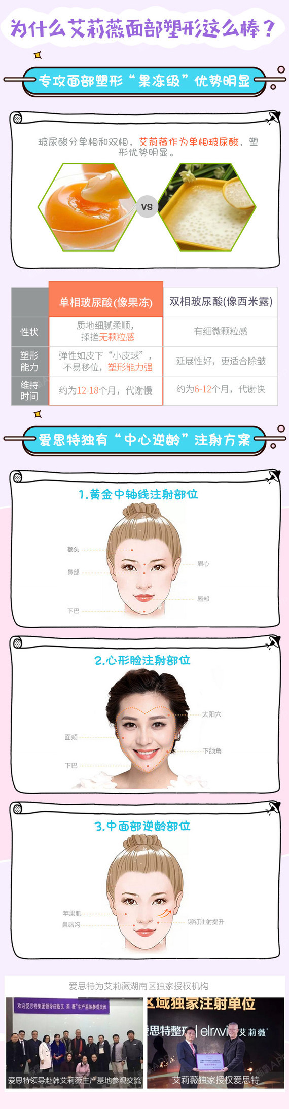 【玻尿酸】【艾莉薇】新氧下单立减100/大分子/足量/保真,丰苹果肌