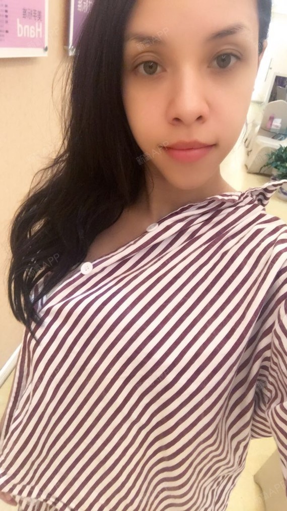 第3天