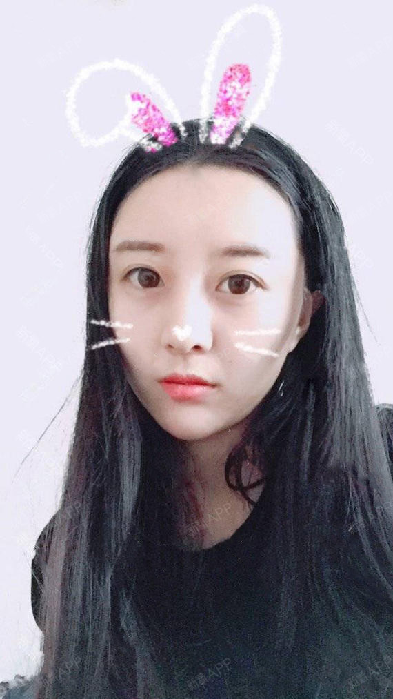 jhiu鼻综合第4天美丽日记-新氧美容整形