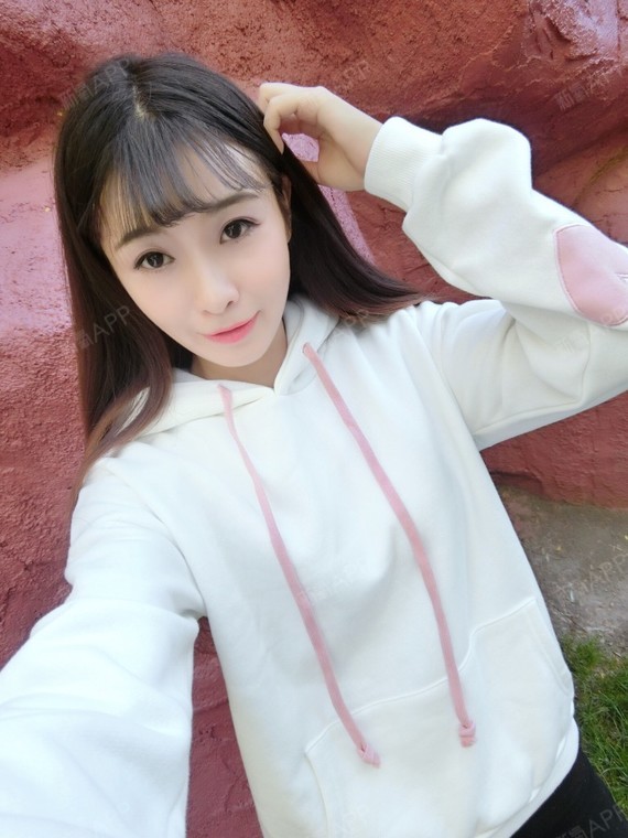 大碴子姑娘520自体脂肪填充脸颊第45天美丽日