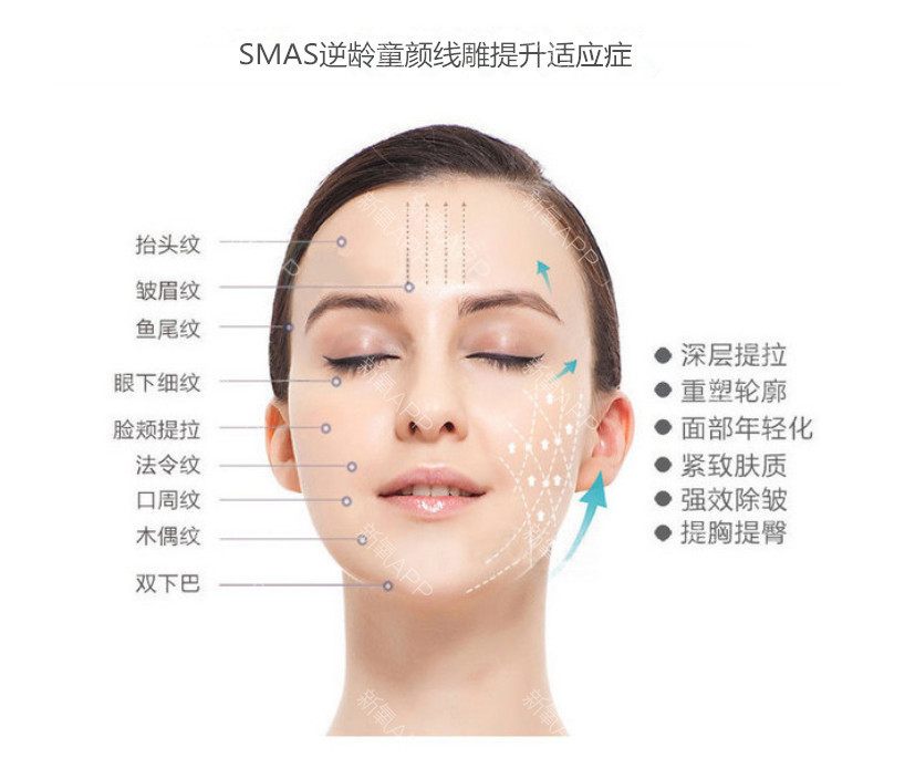 【拉皮提升】逆转时光 面部提升 除皱 去除鱼尾纹 鼻沟纹 法令纹 木偶