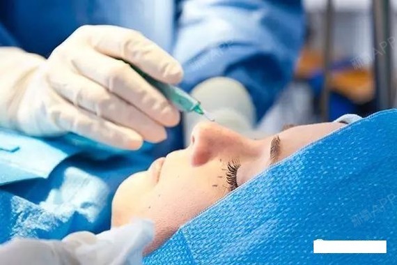 脂肪填充能维持多久医生注射多少量是关键很多