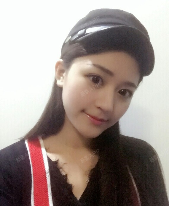 李夏燕半永久纹眉术后第天美丽日记_新氧整形
