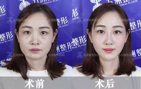 武汉五洲莱美整形美容医院美丽日记