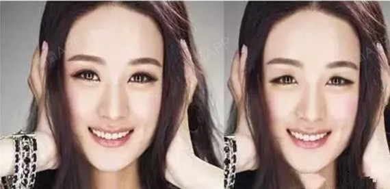 单眼皮vs双眼皮到底哪种好看?