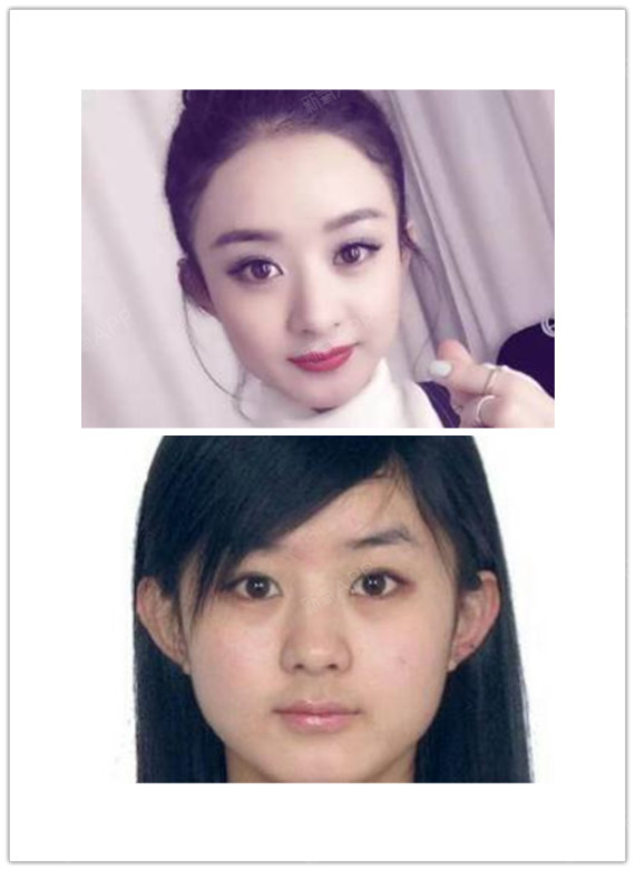 赵丽颖以前是个内双, 如今变成了 标准的双眼皮.
