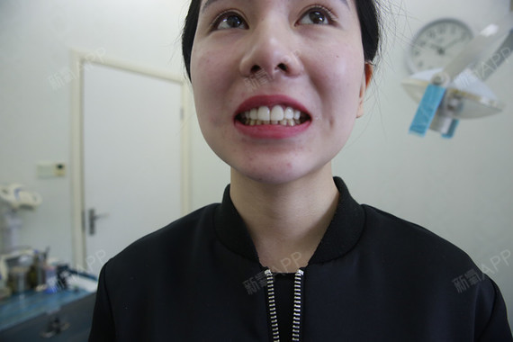 新氧 - 金佳佳 | 牙齿 | 牙齿美容 | 术后当自强 | 贴