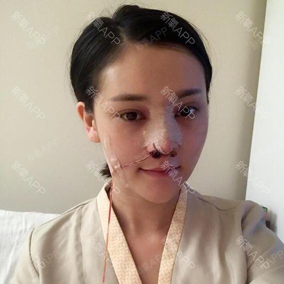 我是超级无敌隆鼻耳丽日复合美女第0天美软骨记省美女茶荣越南图片