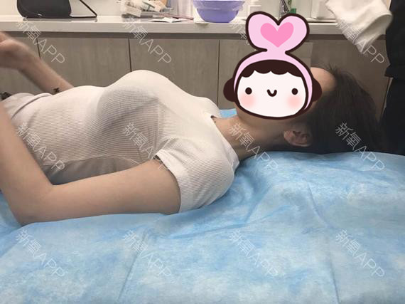 隆胸280cc手术效果图,隆胸300cc效果图 假体隆胸怎么样_恢复过程_效果如何_氧气b5jb386整形