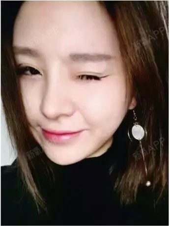 她只做了个鼻子,整个五官都不一样了!人生的改