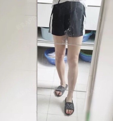 氧气9858921505615450肉毒素瘦小腿第39天