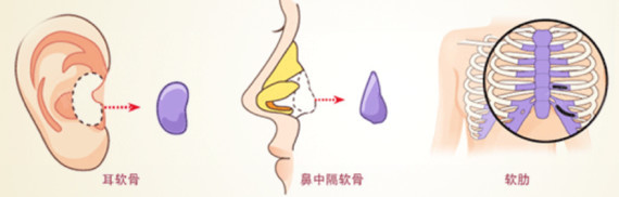 新氧 - 氧气姐 | 鼻部 | 隆鼻 | 鼻头整形 | 北京同城 | 深圳同城 新氧 - 氧气姐 | 鼻部 | 隆鼻 | 鼻头整形 | 北京同城 | 深圳同城