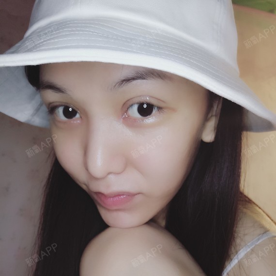 没怎么戒口,广东人,本来就习惯清淡也不太爱吃辣