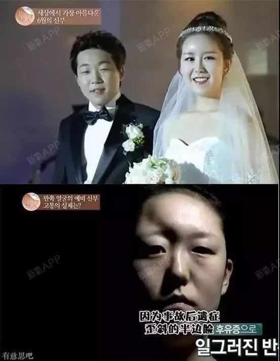 了韩国美人直到初中《let节目秀》整容现在我还有什么学校经典石鼓区?图片