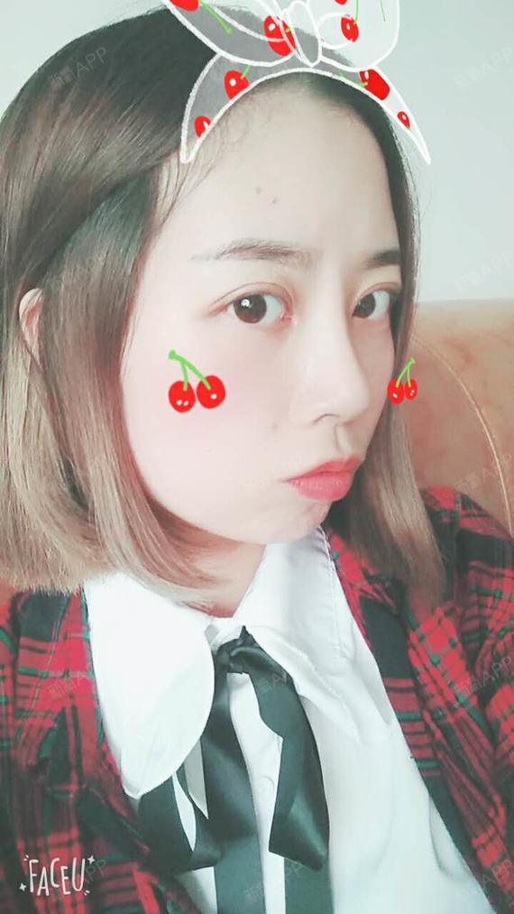 气7599041505712462膨体隆鼻第19天美丽日