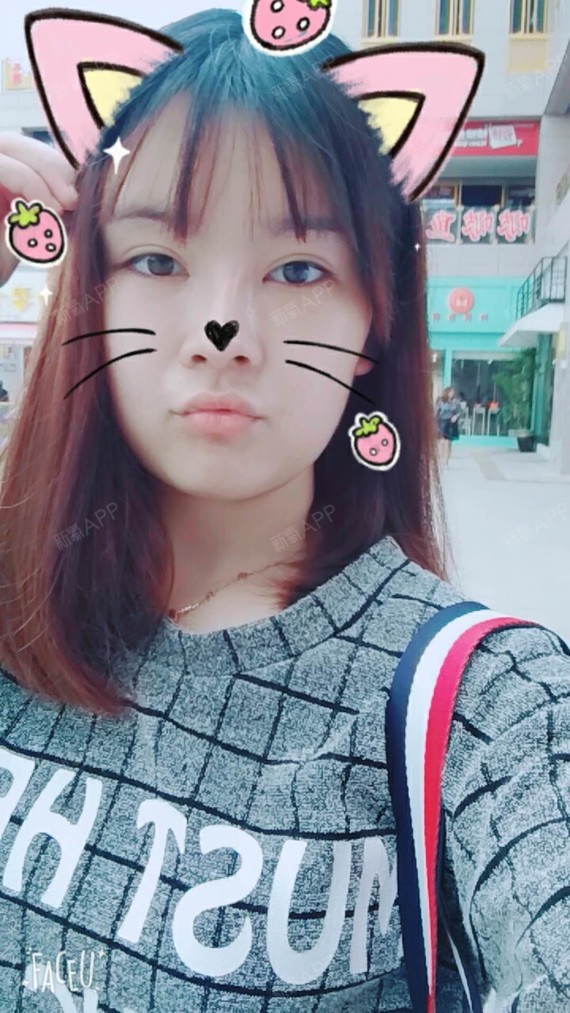 阁楼里的小花F自体脂肪填充全脸第91天美丽日