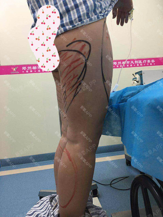 案例分析:    求妹自诉:我大腿和屁股比较粗,穿什么裤子都不好看