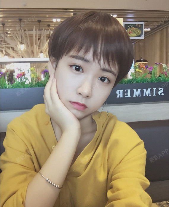 好好说话玻尿酸垫下巴第97天美丽日记-新氧美